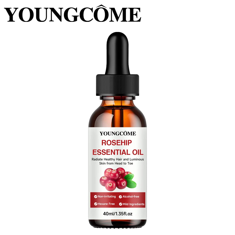 Youngcome Rosehip Essential Oil bottle on a white background