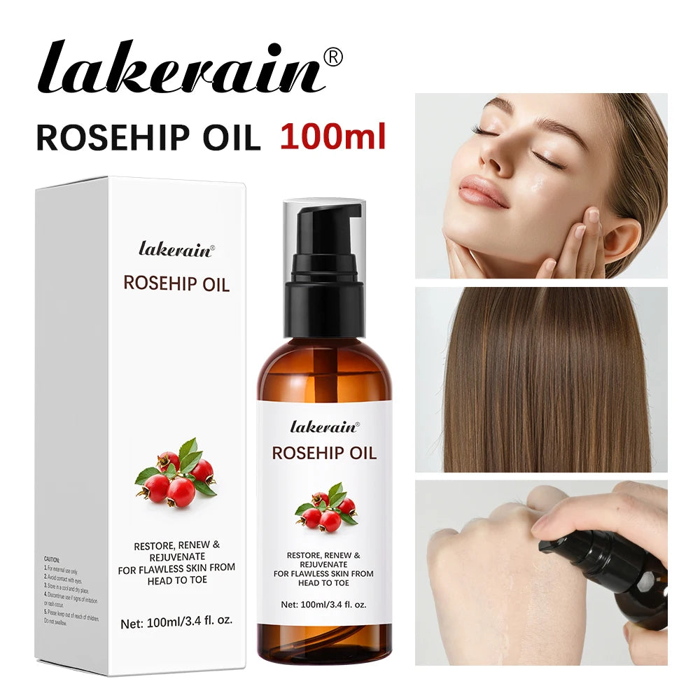 Lakerain Rosehip Oil 100ml – Anti-Ageing, Scar Treatment & Moisturising Face Oil