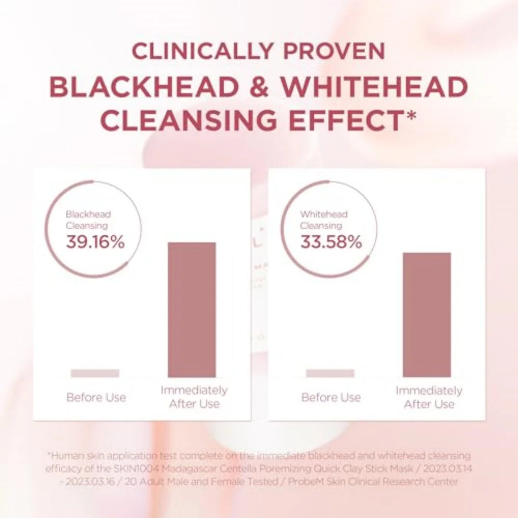 A marketing infographic with the headline 'CLINICALLY PROVEN BLACKHEAD & WHITEHEAD CLEANSING EFFECT*' on a pale pink background. Below, two white panels show cleansing results: blackhead cleansing at 39.