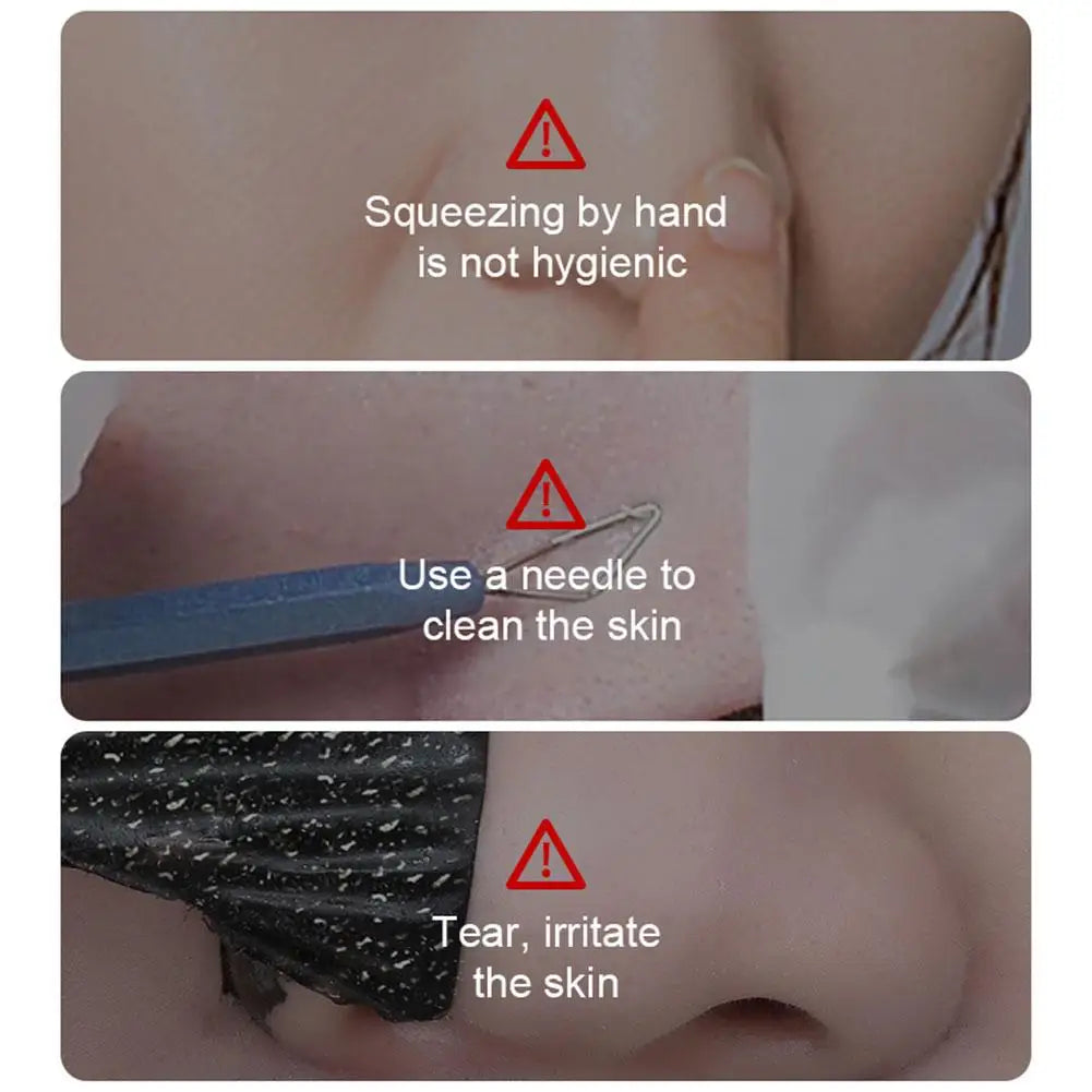 Steps showing improper blackhead removal methods with warning signs.