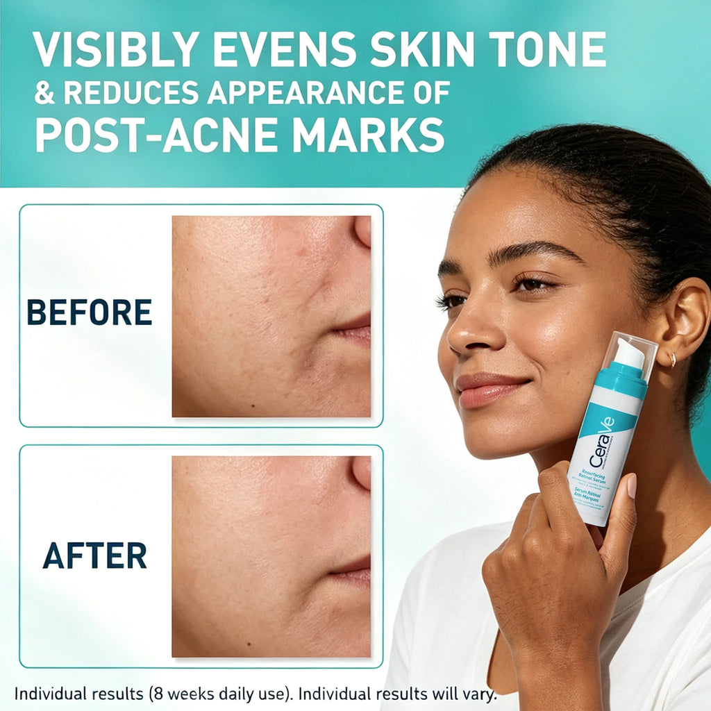 A woman holds a CeraVe skincare tube against her face while the graphic shows before-and-after skin texture closeups and text claiming it evens skin tone and reduces post-acne marks.