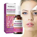 West&Month Rosehip Rejuvenating Essence shown with its purple and white retail box and amber dropper bottle, alongside a split-face beauty graphic on a light gray background.