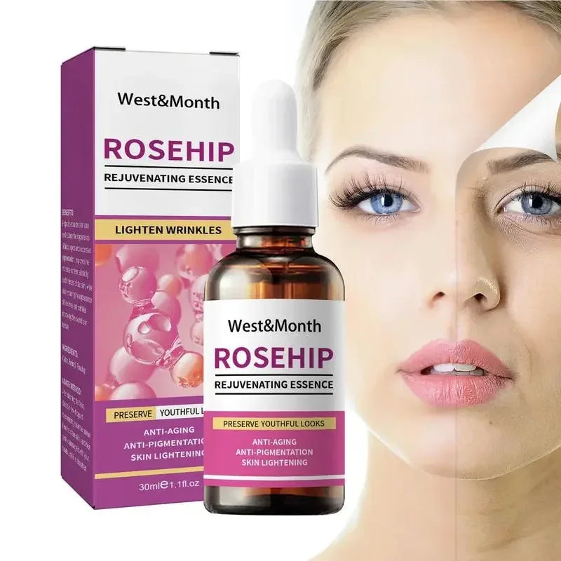 West&Month Rosehip Rejuvenating Essence shown with its purple and white retail box and amber dropper bottle, alongside a split-face beauty graphic on a light gray background.