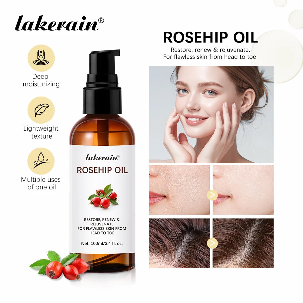 Lakerain Rosehip Oil 100ml – Anti-Ageing, Scar Treatment & Moisturising Face Oil