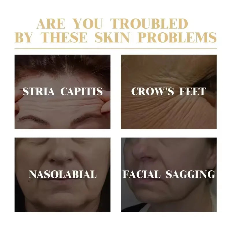Advertisement showing skin concerns like stria capitis, crow's feet, nasolabial folds, and facial sagging.