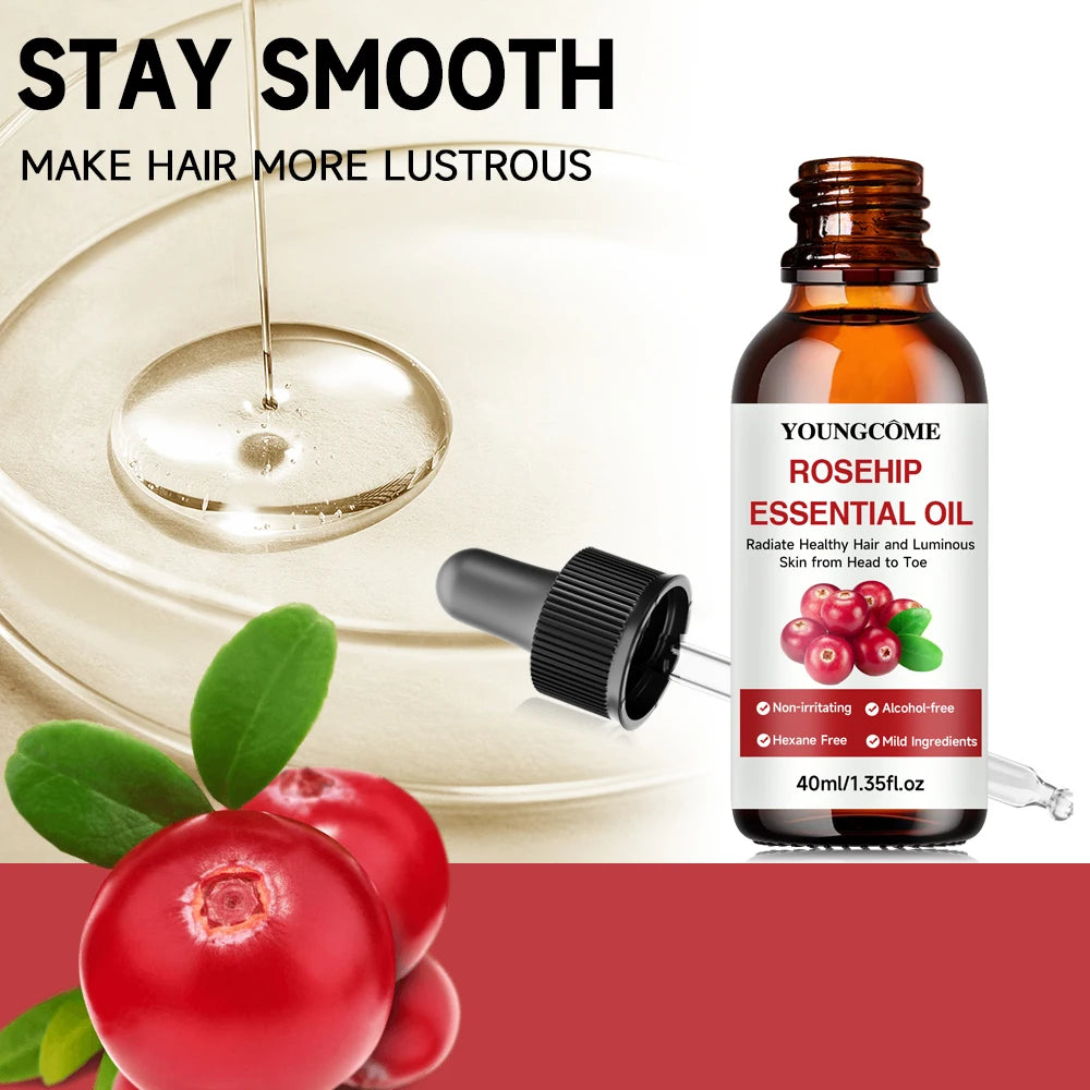 Youngcome Rosehip Essential Oil bottle with dropper, rosehip fruit, and oil droplet on a white background.
