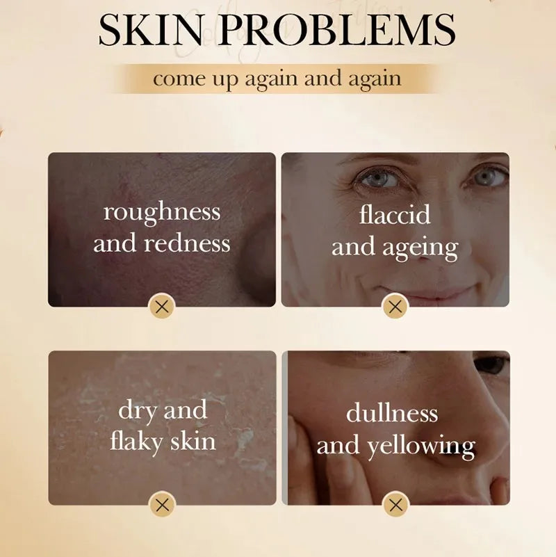 Illustration of skin issues with text labels on a beige background