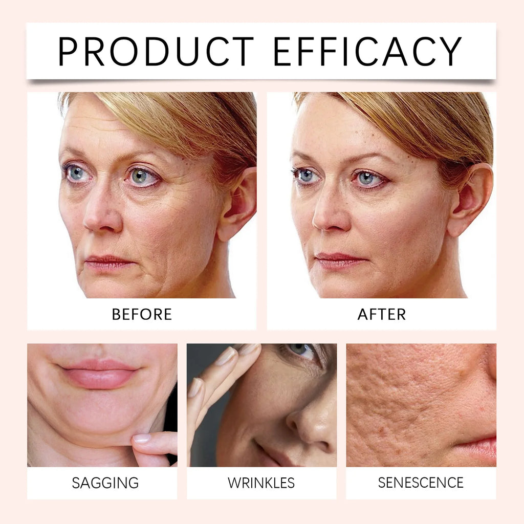 Before and after comparison of a woman's face with text indicating product efficacy on a beige background.
