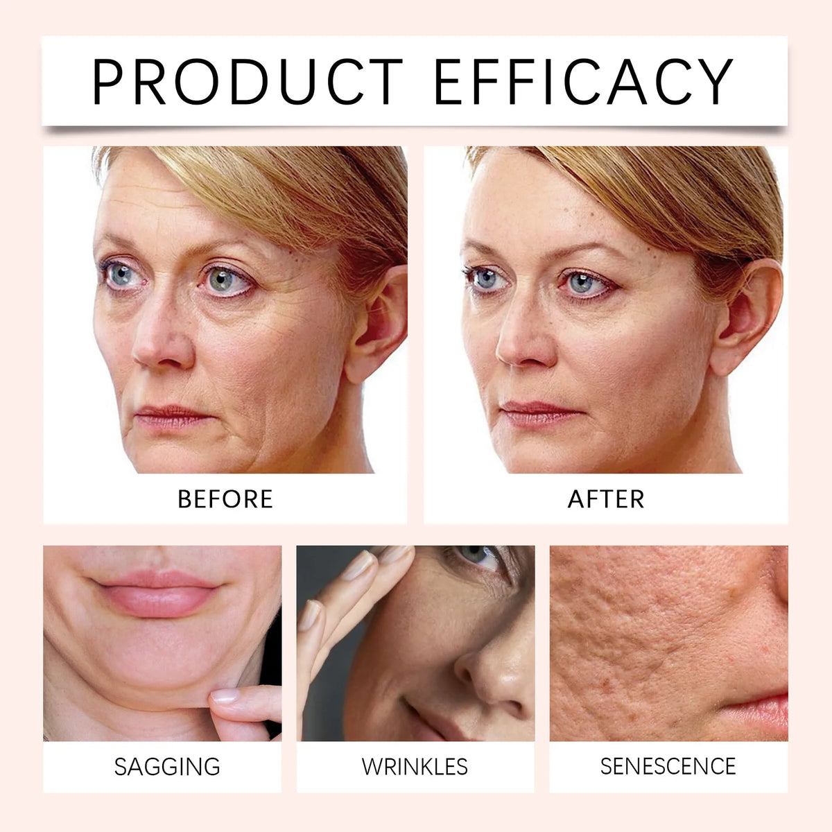 Before and after comparison of a woman's face with text indicating product efficacy on a beige background.