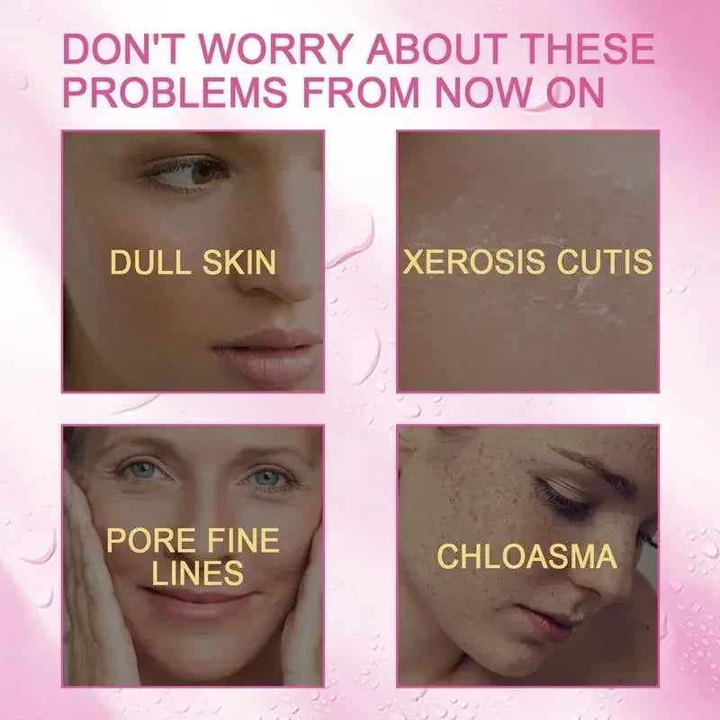 Promotional graphic with pink background and text reading 'DON'T WORRY ABOUT THESE PROBLEMS FROM NOW ON' above four inset skin close-ups labeled 'DULL SKIN,' 'XEROSIS CUTIS,' 'PORE FINE LINES,' and 'CHLOASMA.'.