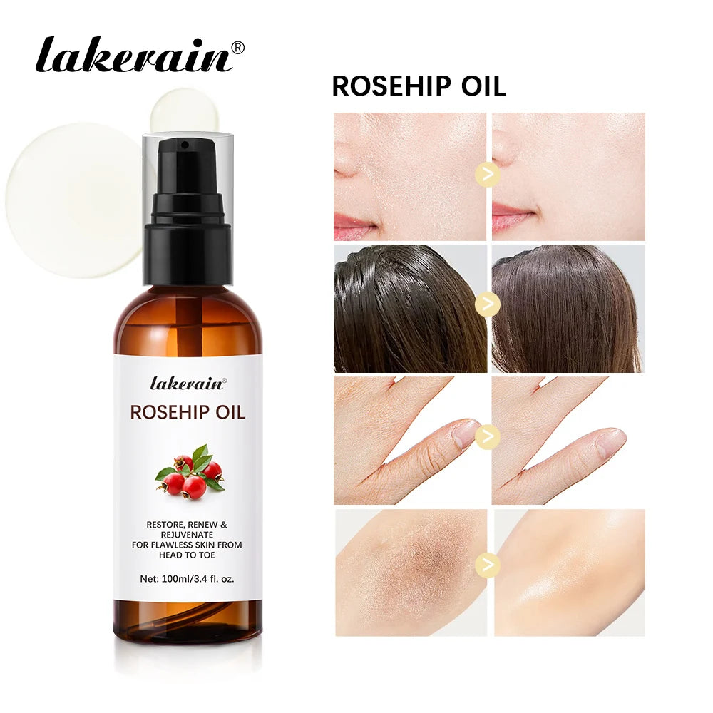 Lakerain Rosehip Oil bottle with application examples on a white background