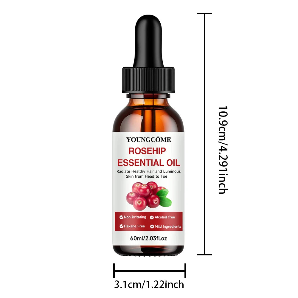 Youngcome Rosehip Essential Oil bottle with dropper and measurements on a white background