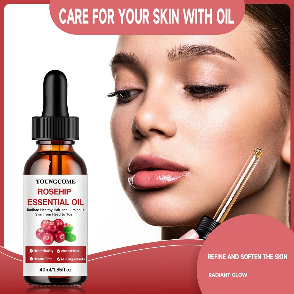 Youngcome Rosehip Essential Oil bottle with a woman's face and text about skin care.